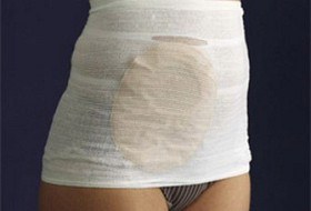 Bild på CareFix StomaSafe classic fixeringsgördel XL 115-145 cm 3 st