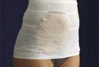 CareFix StomaSafe classic fixeringsgördel XL 115-145 cm 3 st